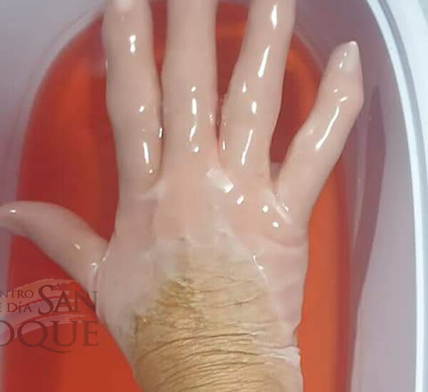 Tratamiento con parafina en Centro de Día San Roque